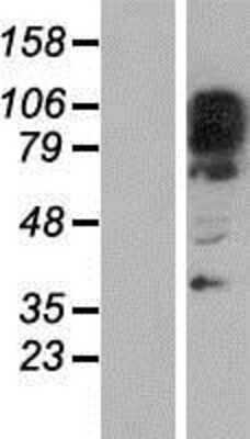 Western Blot: GM632 Overexpression Lysate (Adult Normal) [NBP2-06616] Left-Empty vector transfected control cell lysate (HEK293 cell lysate); Right -Over-expression Lysate for GM632.