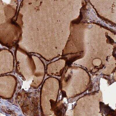 Immunohistochemistry GMCL1 Antibody