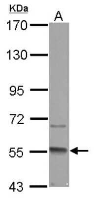 Western Blot GMCL1 Antibody