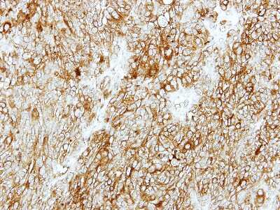 Immunohistochemistry-Paraffin GMDS Antibody