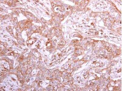 Immunohistochemistry-Paraffin GMDS Antibody