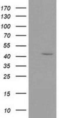 Western Blot: GMDS Antibody (OTI2A1) - Azide and BSA Free [NBP2-70835] - HEK293T cells were transfected with the pCMV6-ENTRY control (Left lane) or pCMV6-ENTRY GMDS (Right lane) cDNA for 48 hrs and lysed. Equivalent amounts of cell lysates (5 ug per lane) were separated by SDS-PAGE and immunoblotted with anti-GMDS.