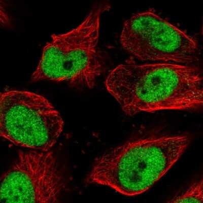 <b>Orthogonal Strategies Validation. </b>Immunocytochemistry/Immunofluorescence: GMEB1 Antibody [NBP2-55657] - Staining of human cell line U-251 MG shows localization to nucleoplasm.