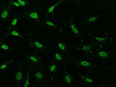 Immunocytochemistry/Immunofluorescence: GMEB1 Antibody [NBP2-99588] - Immunofluorescence staining of GMEB1 in Hela cells. Cells were fixed with 4% PFA, permeabilzed with 0.1% Triton X-100 in PBS, blocked with 10% serum, and incubated with rabbit anti-human GMEB1 polyclonal antibody (dilution ratio 1:1000) at 4C overnight. Then cells were stained with the Alexa Fluor(R)488-conjugated Goat Anti-rabbit IgG secondary antibody (green). Positive staining was localized to Nucleus .