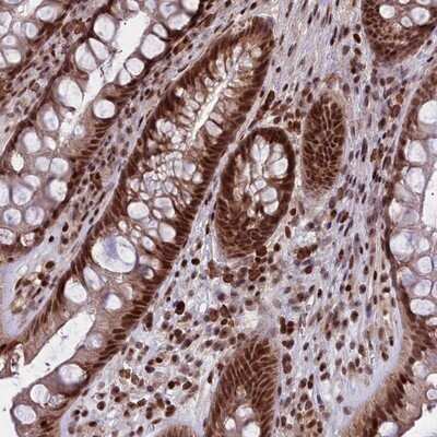 Immunohistochemistry-Paraffin: GMEB1 Antibody [NBP1-91949] - Staining of human rectum shows strong nuclear positivity in glandular cells.