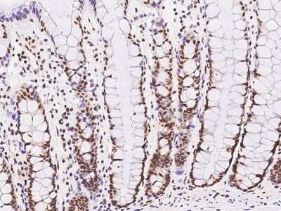 Immunohistochemistry-Paraffin: GMEB1 Antibody [NBP2-99588] - Immunochemical staining of human GMEB1 in human rectum with rabbit polyclonal antibody at 1:1000 dilution, formalin-fixed paraffin embedded sections.