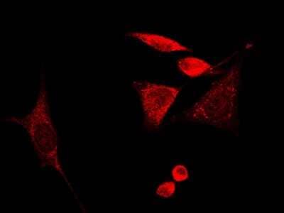 Immunocytochemistry/Immunofluorescence: GMF-beta Antibody [NBP2-98937] - Immunofluorescence staining of GMF-beta in HeLa cells. Cells were fixed with 4% PFA, blocked with 10% serum, and incubated with rabbit anti-human GMF-beta polyclonal antibody (1:1000) at 4C overnight. Then cells were stained with the Alexa Fluor(R)594-conjugated Goat Anti-rabbit IgG secondary antibody (red).Positive staining was localized to cytoplasm and nucleus.