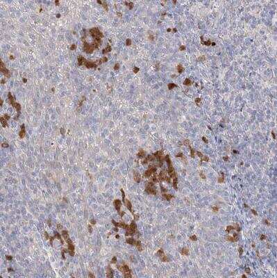Immunohistochemistry-Paraffin: GMPPA Antibody [NBP1-85904] -  Staining of human tonsil shows moderate cytoplasmic positivity in lymphoid cells.