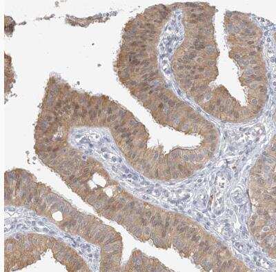 Immunohistochemistry-Paraffin: GMPPA Antibody [NBP1-85904] -  Staining of human fallopian tube shows moderate to strong cytoplasmic positivity in glandular cells.