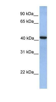 Western Blot: GMPPA Antibody [NBP1-55233] - Human Lung lysate, concentration 0.2-1 ug/ml.