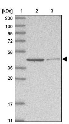 Western Blot GMPPA Antibody - BSA Free