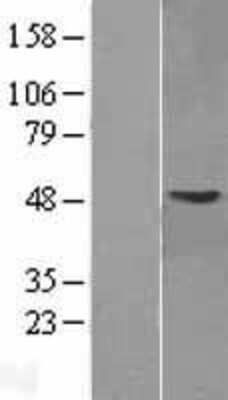 Western Blot: GMPPA Overexpression Lysate (Adult Normal) [NBP2-09851] Left-Empty vector transfected control cell lysate (HEK293 cell lysate); Right -Over-expression Lysate for GMPPA.