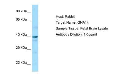 Western Blot: GNA14 Antibody [NBP1-98546] - Antibody Dilution: 1.0ug/ml Sample Tissue: Human brain.