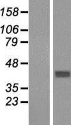 Western Blot: GNA14 Overexpression Lysate (Adult Normal) [NBP2-07884] Left-Empty vector transfected control cell lysate (HEK293 cell lysate); Right -Over-expression Lysate for GNA14.