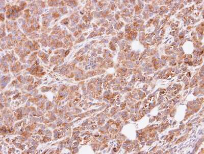 Immunohistochemistry-Paraffin: GNAI3 Antibody [NBP1-32617] - SAS xenograft, using G protein alpha Inhibitor 3 antibody at 1:500 dilution.Antigen Retrieval: Citrate buffer, pH 6.0, 15 min.