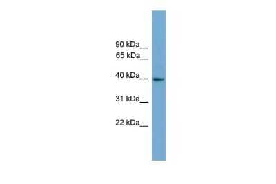 Western Blot: GNAI3 Antibody [NBP2-82234] - WB Suggested Anti-GNAI3 Antibody Titration: 0.2-1 ug/ml. ELISA Titer: 1:62500. Positive Control: Human brain