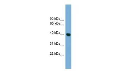 Western Blot: GNAI3 Antibody [NBP2-82235] - WB Suggested Anti-GNAI3 Antibody Titration: 0.2-1 ug/ml. ELISA Titer: 1:312500. Positive Control: HepG2 cell lysate