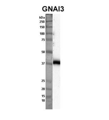 Western Blot: GNAI3 Antibody [NBP2-82235] - Sample Type: Nthy-ori cell lysate (50ug). Primary Dilution: 1:1000. Secondary Antibody: anti-rabbit HRP. Secondary Dilution:. 1:2000. Image Submitted By: Anonymous