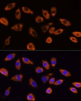 Immunocytochemistry/Immunofluorescence: GNB1 Antibody [NBP3-04689] - Analysis of L929 cells using GNB1 Rabbit pAb at dilution of 1:100 (40x lens). Blue: DAPI for nuclear staining. GNB1 antibody