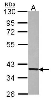 Western Blot: GNB1 Antibody [NBP2-16699] - Sample (30 ug of whole cell lysate) A: JurKat 10% SDS PAGE gel, diluted at 1:5000.