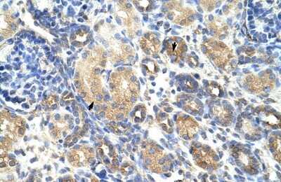 Immunohistochemistry-Paraffin GNB1L Antibody