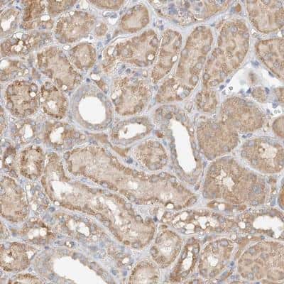 Immunohistochemistry-Paraffin: GNB1L Antibody [NBP1-81787] - Staining of human kidney shows moderate cytoplasmic positivity in tubule cells.