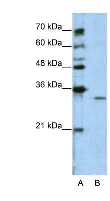 Western Blot GNB1L Antibody