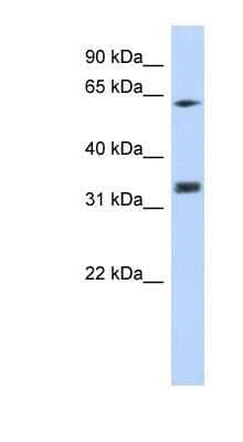 Western Blot: GNB2L1 Antibody [NBP1-58959] - Transfected 293T, Antibody Titration: 0.2-1 ug/ml