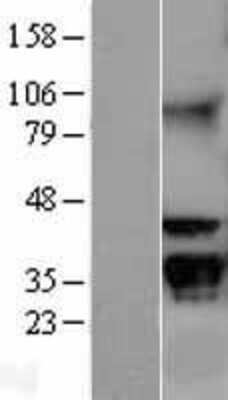 Western Blot: GNB2L1 Overexpression Lysate (Adult Normal) [NBL1-11166] Left-Empty vector transfected control cell lysate (HEK293 cell lysate); Right -Over-expression Lysate for GNB2L1.