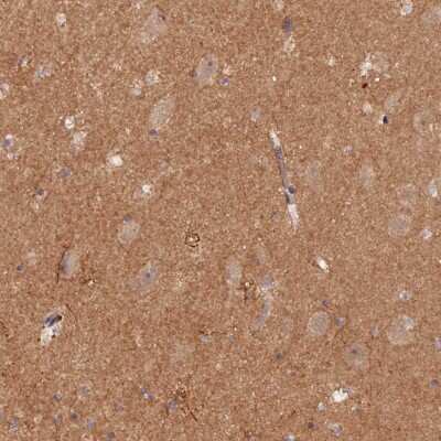 Immunohistochemistry-Paraffin: GNB5 Antibody [NBP1-83390] - Staining of human hippocampus shows moderate cytoplasmic positivity in neuropil.
