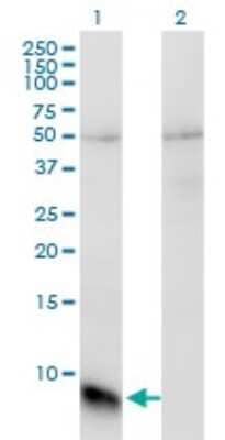 Western Blot: GNGT1 Antibody (1F8) [H00002792-M01] - Analysis of GNGT1 expression in transfected 293T cell line by GNGT1 monoclonal antibody (M01), clone 1F8.Lane 1: GNGT1 transfected lysate(8.5 KDa).Lane 2: Non-transfected lysate.