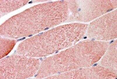 Immunohistochemistry-Paraffin: GNIP Antibody [NB100-1229] - (3.8ug/ml) staining of Human Skeletal Muscle. Steamed antigen retrieval with citrate buffer pH 6, AP-staining.