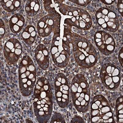 Immunohistochemistry-Paraffin: GNIP Antibody [NBP1-89751] - Staining of human colon shows strong cytoplasmic positivity in glandular cells.