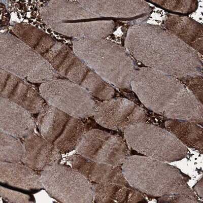 Immunohistochemistry-Paraffin: GNIP Antibody [NBP1-89751] - Staining of human skeletal muscle shows strong cytoplasmic positivity in myocytes.