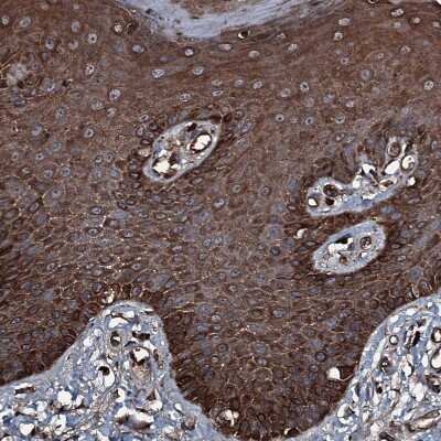 Immunohistochemistry-Paraffin: GNIP Antibody [NBP1-89751] - Staining of human skin shows strong cytoplasmic positivity in squamous epithelial cells.