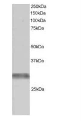 Western Blot GNIP Antibody