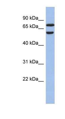Western Blot: GNL3L Antibody [NBP1-55240] - Human Lung lysate, concentration 0.2-1 ug/ml.