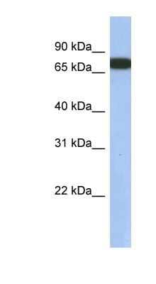 Western Blot: GNL3L Antibody [NBP1-55241] - Human Lung lysate, concentration 0.2-1 ug/ml.