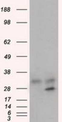Western Blot: GNMT Antibody (8A3) [NBP2-02634] HEK293T cells were transfected with the pCMV6-ENTRY control (Left lane) or pCMV6-ENTRY GNMT (Right lane) cDNA for 48 hrs and lysed. Equivalent amounts of cell lysates (5 ug per lane) were separated by SDS-PAGE and immunoblotted with anti-GNMT.