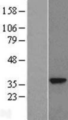 Western Blot: GNMT Overexpression Lysate (Adult Normal) [NBL1-11186] Left-Empty vector transfected control cell lysate (HEK293 cell lysate); Right -Over-expression Lysate for GNMT.