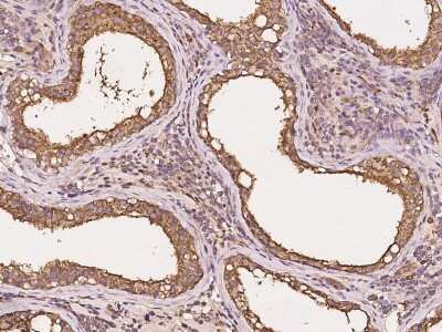 Immunohistochemistry-Paraffin: GNPDA2 Antibody [NBP2-99589] - Immunochemical staining of human GNPDA2 in human testis with rabbit polyclonal antibody at 1:5000 dilution, formalin-fixed paraffin embedded sections.