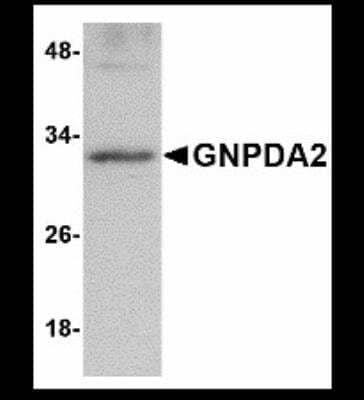 Western Blot: GNPDA2 Antibody [NBP1-72110] - Human kidney lysate with GNPDA2 antibody at 1 ug/ml