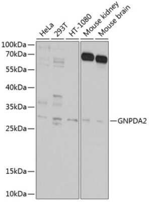 Western Blot GNPDA2 Antibody - BSA Free