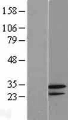 Western Blot GNPDA2 Overexpression Lysate