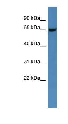 Western Blot: GNS Antibody [NBP1-68917] - Titration: 0.2-1 ug/ml, Positive Control: Rat Heart.