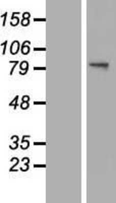 Western Blot: GNS Overexpression Lysate (Adult Normal) [NBL1-11193] Left-Empty vector transfected control cell lysate (HEK293 cell lysate); Right -Over-expression Lysate for GNS.