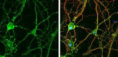 Immunocytochemistry/Immunofluorescence: GO Protein alpha Antibody [NBP2-16703] -  DIV9 rat E18 primary hippocampal neuron cells were fixed in 4% paraformaldehyde at RT for 15 min. Green: GNAO1 stained by GNAO1 antibody  diluted at 1:500.Red: beta Tubulin 3/ Tuj1, stained by beta Tubulin 3/ Tuj1 antibody [1338] (GTX631831) diluted at 1:500. Blue: Fluoroshield with DAPI.