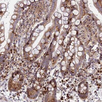 Immunohistochemistry-Paraffin: GOLGA3 Antibody [NBP1-91952] - Staining of human colon shows strong cytoplasmic positivity in lymphoid cells.