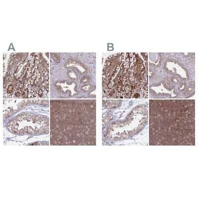 <b>Independent Antibodies Validation. </b>Immunohistochemistry-Paraffin: GOLGA3 Antibody [NBP1-91952] - Staining of human colon, prostate, testis and tonsil using Anti-GOLGA3 antibody NBP1-91952 (A) shows similar protein distribution across tissues to independent antibody NBP1-91953 (B).