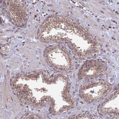 Immunohistochemistry-Paraffin: GOLGA3 Antibody [NBP1-91952] - Staining of human prostate shows moderate granular cytoplasmic positivity in glandular cells.